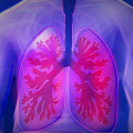 Exploring the Link Between Asbestos Exposure and Lung Cancer