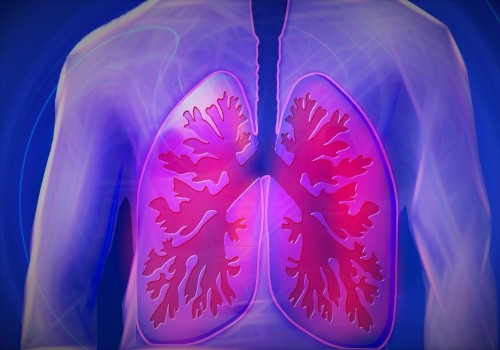 Exploring the Link Between Asbestos Exposure and Lung Cancer